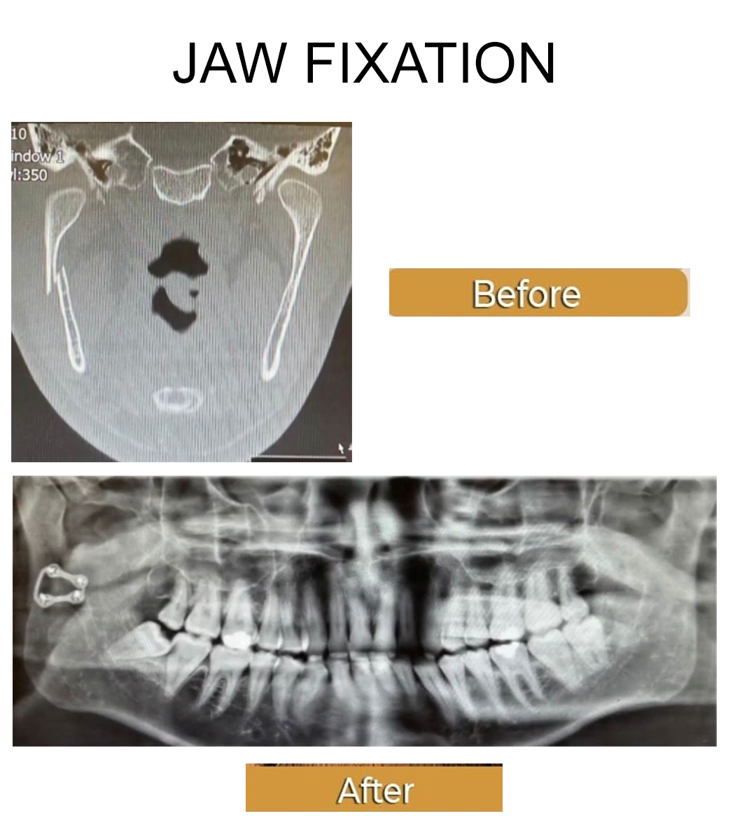 Facial Surgery