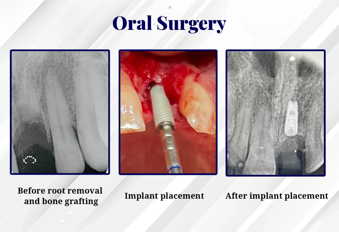 Facial Surgery